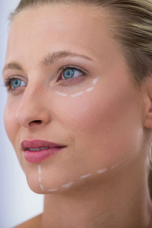 Chemical Peels & Bleaching Creams