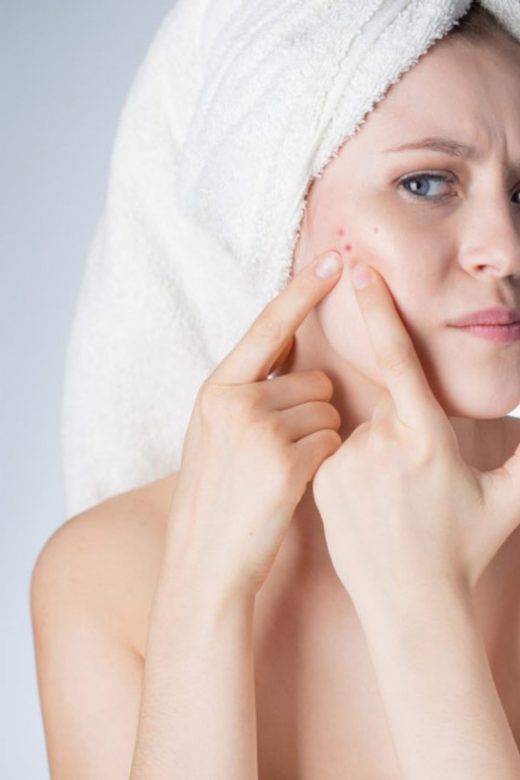 Best Skin Care Solutions Against Acne