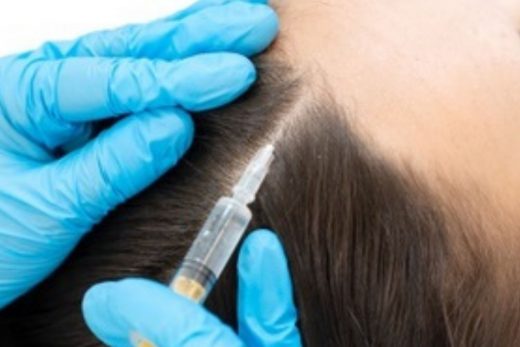 8 Simple Ways to Get Rid of White Hair at a Young Age