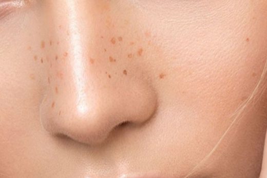 What Should I Know About Aging Skin
